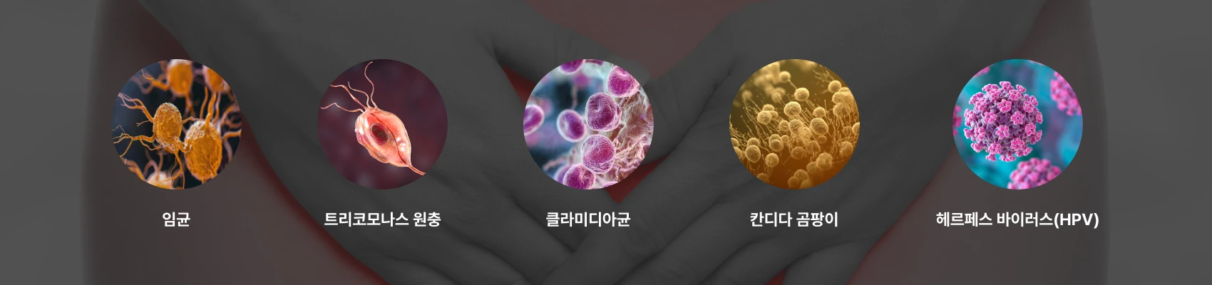 자궁경부염·자궁경부암